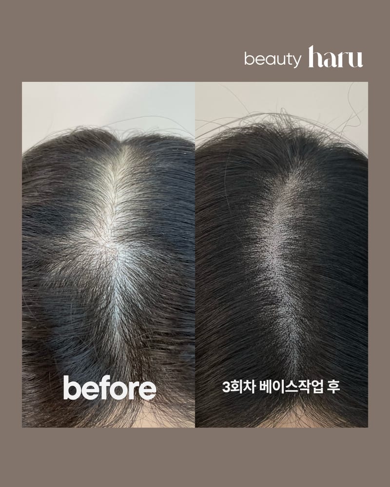 [인천 연수구] 뷰티하루 송도두피문신 체험단