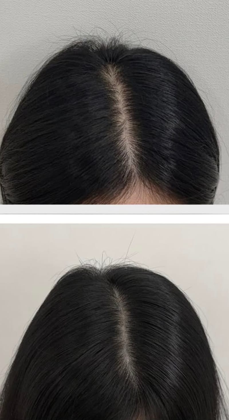[경북 포항시] 포항두피문신톤오브 뷰티샵 체험단