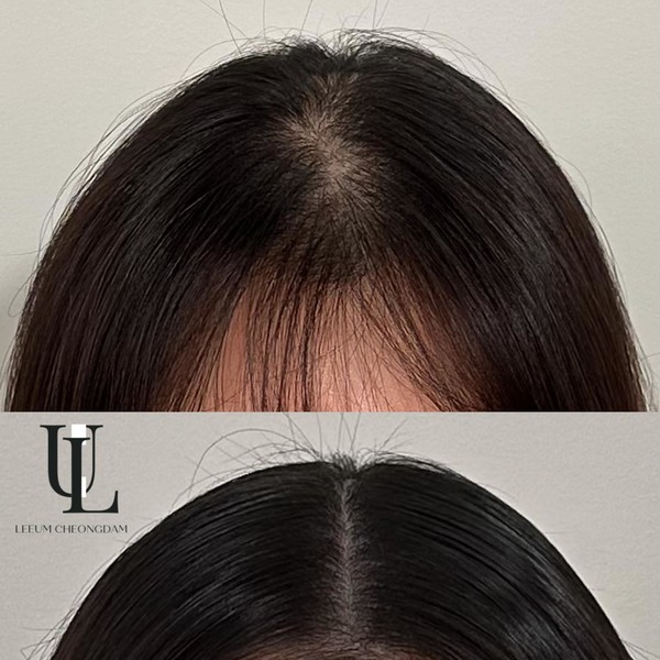 [서울 강남] 더 리움(The Leeum)