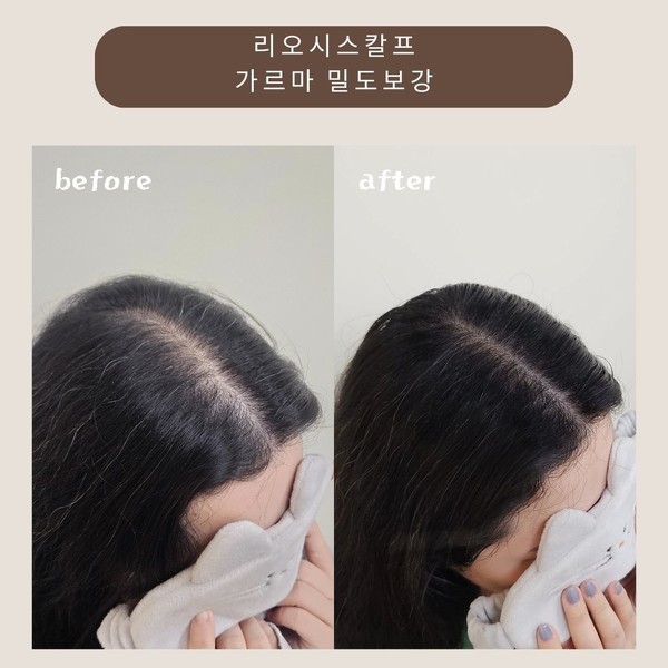 [대구 달서구] 리오시스칼프